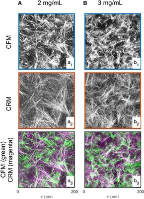 Remodelling of the fibre-aggregate structure of collagen gels by cancer-associated fibroblasts: A time-resolved grey-tone image analysis based on stochastic modelling